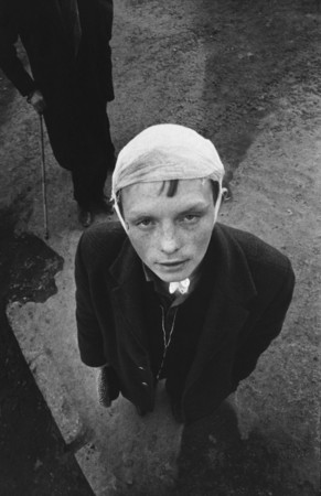 Viktor Ershov.
A boy with bandage on his head. 
1970’s